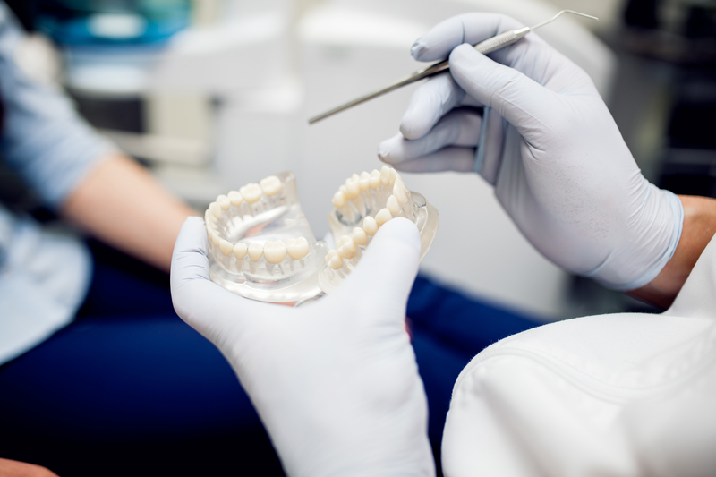 Безметалеві коронки на імплантах у Києві: у чому їх перевага — Solovei Dental Clinic